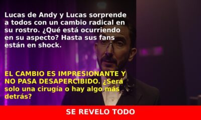 La sorprendente transformación de la nariz de Lucas de Andy y Lucas